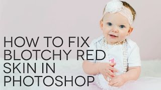 How to Fix Blotchy Red Skin in Photoshop [upl. by Artamas]