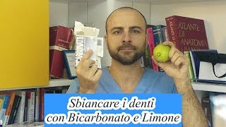 video sbiancamento [upl. by Eniamert]