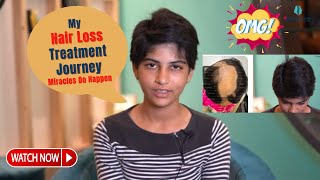 Alopecia Areata Treatment by Dr Jangid  Patient Testimonial  Best Hair Transplant Surgeon  Delhi [upl. by Ambrosine736]