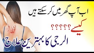 Allergy Treatment  skin allergy treatment at home  skin allergy ka ilaj  skin allergy itching [upl. by Peednas]