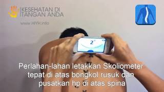 Scoliometer untuk iPhone dan Android  CARA PAKAI [upl. by Anidan]