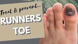 Runners Toe How to prevent and treat black toenails [upl. by Oilcareh]