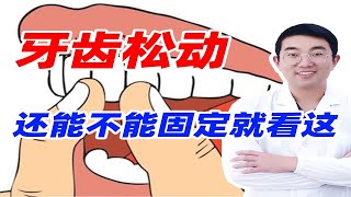 牙齿松动别急着拔，还能这样固定！ [upl. by Ahsennek]