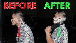 Restore Your Neck Posture amp Curve  Cervical Lordosis [upl. by Lanuk]