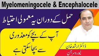 Myelomeningocele And Myelomeningocele CausesSymptoms And Treatment In Urdu [upl. by Gensmer]