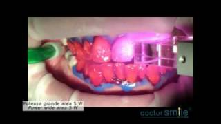 Doctor Smile Whitening Bleachingflv [upl. by Vaughan]