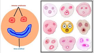 Histología del cordón umbilical junto con Dr Quetglas [upl. by Ecnarual]