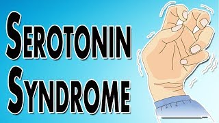 Managing Serotonin Syndrome [upl. by Chi731]