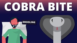 A case of Cobra Bite Emergency Snake Venom Animation [upl. by Yerd]