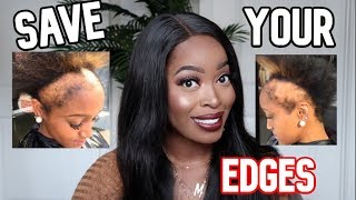 ‼️SAVE YOUR EDGES 🚫STOP DOING THIS WITH YOUR LACE WIGS ⚠️Tips for Hair Growth ft Nadula Hair [upl. by Posner]