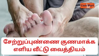 Setru punAthletes foot  treatment in Tamil  சேற்றுப் புண் குணமாக்க எளிய வீட்டு வைத்தியம் [upl. by Pomfret]