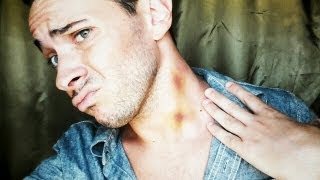 How to Remove a Hickey FAST  Tip 94 [upl. by Isahella975]