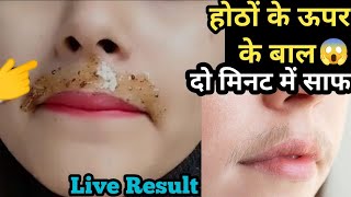 इस चीज से होठों के ऊपर के बाल ऐसे हट गए😱 2 मिनट में मैं तो हैरान हू🤔 upper lip hair removal [upl. by Koralie]