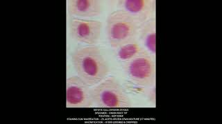 Mitosis  Cell Division different stages under Microscope biology neet agriculture genetics [upl. by Yesor938]