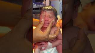 Nose massage babyreview newbornbaby morevews baby babyborn cute newborn love [upl. by Laro]