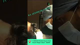 Say Goodbye to Thinning Hair with PRP Therapy hairprp prpprptherapy hairtransplant RLAESTHETIC [upl. by Rich726]