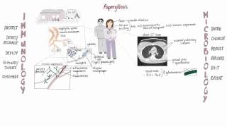 Aspergillus Springboard [upl. by Ala]