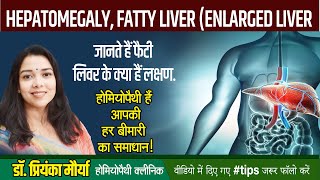 HEPATOMEGALY FATTY LIVER ENLARGED LIVER [upl. by Ahcsap420]