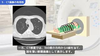 胸部CT検査について（長野赤十字病院 健診センター） [upl. by Pete]