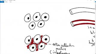 GENERAL PATHOLOGY 5  amyloidosis  structure  pathogenesis classification DR SAMEH GHAZY [upl. by Sivla722]