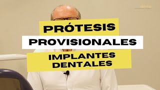 La importancia de los provisionales para los implantes dentales [upl. by Ttennaj]