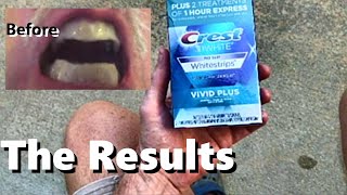 CREST Whitening Strips 3D BeforeAfter 12 Treatments Vivid Plus Teeth Enamel Cleaning 30 minutes [upl. by Kaden]