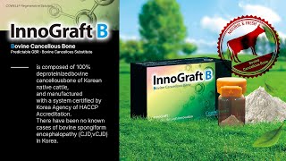 New Product Launch Introducing InnoGraft B with Clinical Case [upl. by Pelag]