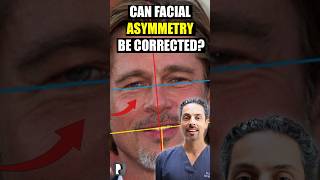 Can Facial Asymmetry be corrected London Facial Plastic Surgeon answers facialsurgery [upl. by Lajet]