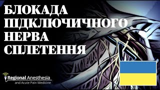 БЛОКАДА ПІДКЛЮЧИЧНОГО НЕРВА СПЛЕТЕННЯ 🇺🇦 Infraclavicular Brachial Plexus Block [upl. by Bury562]