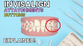 Invisalign Attachments and Buttons  How do they work  Explained in 4 minutes [upl. by Adalai]