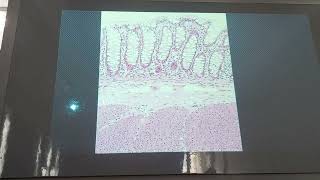 Histología  sistema digestivo  parte 10  191124 [upl. by Akemrehs]