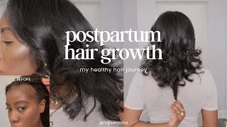 Postpartum Hair Loss  10 Things I Did To Get My Hair Healthy and Growing [upl. by Keeley304]