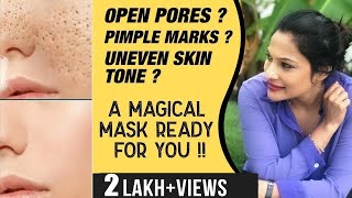 Open pores Pimple marks Uneven Skin Tone A Magical mask ready for you   Rethikas Just My Way [upl. by Sikata584]