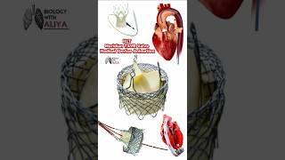 HLT Meridian TAVR Valve Medical Device Animation medical animation 3d short BiologywithAliya [upl. by Major315]