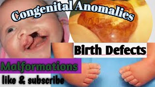 Basics of Congenital Anomalies Birth Defects Malformations [upl. by Allimac]