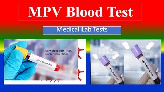 MPV Blood Test  Medical Lab Tests  What is   Uses  Need  Preparation  Results [upl. by Seamus356]