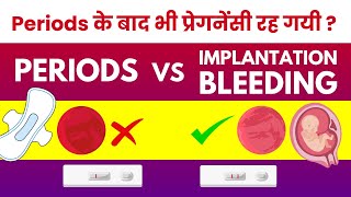 Implantation Bleeding vs Period Miscarriage  Kab Hoti Hai Kitne Din Baad Hoti Hai [upl. by Vanderhoek]