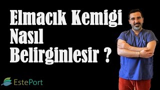 Elmacık Kemiği Belirginleştirme Ameliyatı amp Dr Ali Mezdeği [upl. by Lose206]