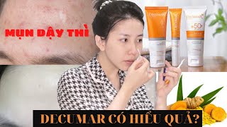 Trị mụn tận gốc tận nhà Combo trị mụn Decumar có thực sự hiệu quả  Mai Trinh Official [upl. by Irreg]