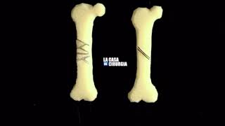 Strain Theory in Bone Fracture [upl. by Sherar]