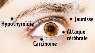 8 Choses Que Tes Yeux Révèlent Sur ta Santé [upl. by Ennobe]