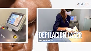 Depilación Láser en Hombres [upl. by Nhepets]