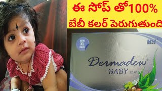 dermadew baby soap review in telugu  baby skin whitening soap dermadew baby soap dermadew [upl. by Kumler]