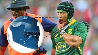 La blessure de Cheslin Kolbe face au Pays de Galles [upl. by Noseimaj]