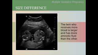 Ultrasound Training Course 15 part 2 [upl. by Aikcin442]