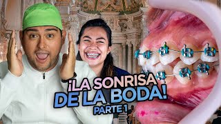 ¡TENÍA LOS DIENTES VOLADOS LE PUSE BRACKETS PARA ACOMODARLO BUEN CASO DE ORTODONCIA [upl. by Rubens202]