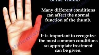 Common Conditions Of The Thumb  Everything You Need To Know  Dr Nabil Ebraheim [upl. by Wendolyn]