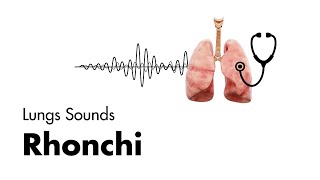 Rhonchi  Lung Sounds  Medzcool [upl. by Ydnas]