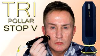 TriPollar Stop V Before amp After  Radiofrequency amp DMA Skin Tightening [upl. by Ylnevaeh]