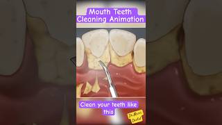 Teeth Cleaning Scaling Animation [upl. by Kassie586]